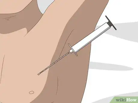 Image titled Detect a Brain Tumor Step 13