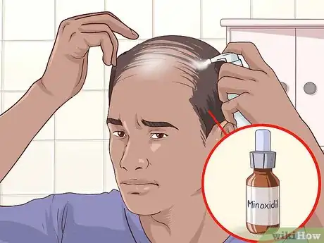 Image titled Regrow Hair Step 3