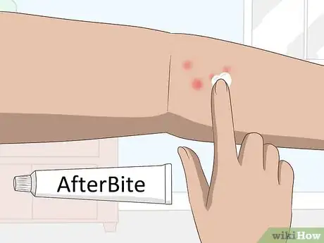 Image titled Stop Gnat Bites from Itching Step 1