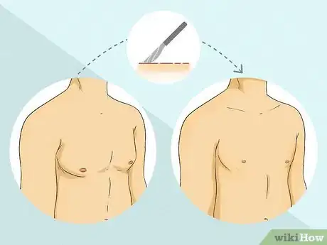 Image titled Hide Gynecomastia at the Beach Step 8