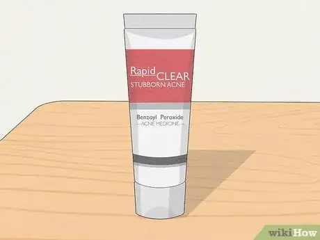 Image titled Get Rid of a Pimple Step 2