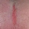 Exclusive Lines on the tongue