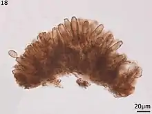 Asperisporium caricae under a microscope, displaying conidiophores and conidium