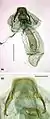 Female genitalia
