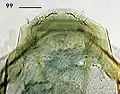 Female terminal abdominal segment