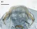 Female terminal abdominal segment