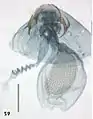 Female genitalia