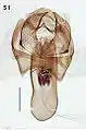 Male genitalia