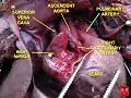 Fetal heart - right coronary artery