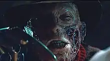 A picture of the face of a man with severe burns. Parts of skin are burned through and appear hollow. The head has a hit and the glove with finger knives is in the forefront.
