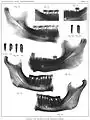 Radiography