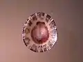 basal view