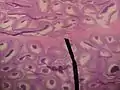 Microscopic picture.