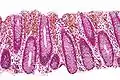 Micrograph of melanosis coli. H&E stain.