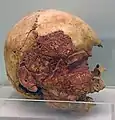 Nigde museum Kosk Hoyuk skull 0878