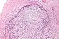 Intermediate magnification