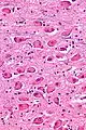 NBM - very high magnification.
