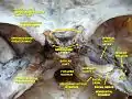 Tympanic cavity. Facial canal. Internal carotid artery.