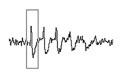 A jagged line with upward-downward deflections. A rectangular box surrounds one deflection.