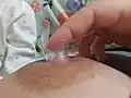 Placing shield