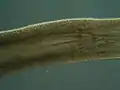 Pharynx of the flatworm Prorhynchus fontinalis