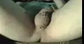 Scrotal Ladder Genital Piercings