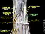 Extensor indicis muscle