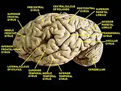 Cerebrum. Lateral view. Deep dissection. Inferior temporal gyrus labeled at bottom center.