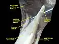 Deep dissection of the mandibular nerve and bone (anterior view)