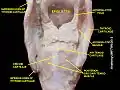 Larynx. Deep dissection. Posterior view.
