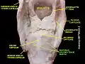 Posterior cricoarytenoid muscle