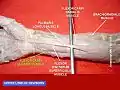 Flexor carpi ulnaris muscle