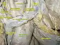 Ascending aorta