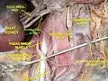 Renal artery