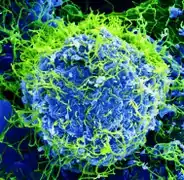 Ebola Virus - Electron Micrograph