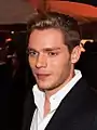 Actor Dominic Sherwood has sectoral heterochromia.