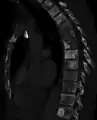 Sclerosis of the bones of the thoracic spine due to prostate cancer metastases (CT image)