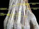 Muscles of hand. Posterior view.