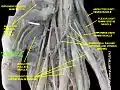 Flexor pollicis brevis muscle