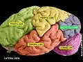 Occipital lobe