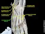 Extensor indicis muscle