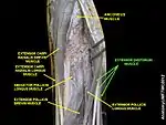 Extensor digitorum muscle