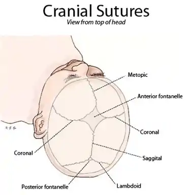 Cranial sutures shown from top of head.