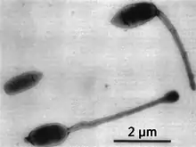Three representative cell types of a culture of "Hyphomicrobium" sp.. Note short processes on two of the three cells, thought to be remnants of the former mother hypha