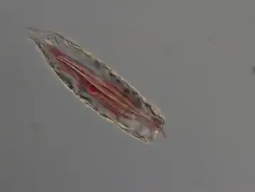 Difflugia_scalpellum